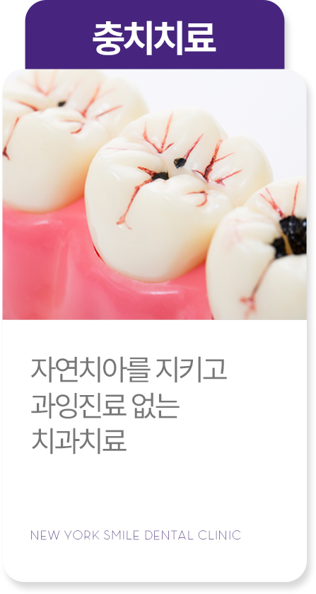 보철치료