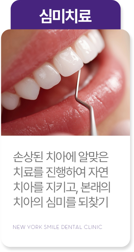 임플란트