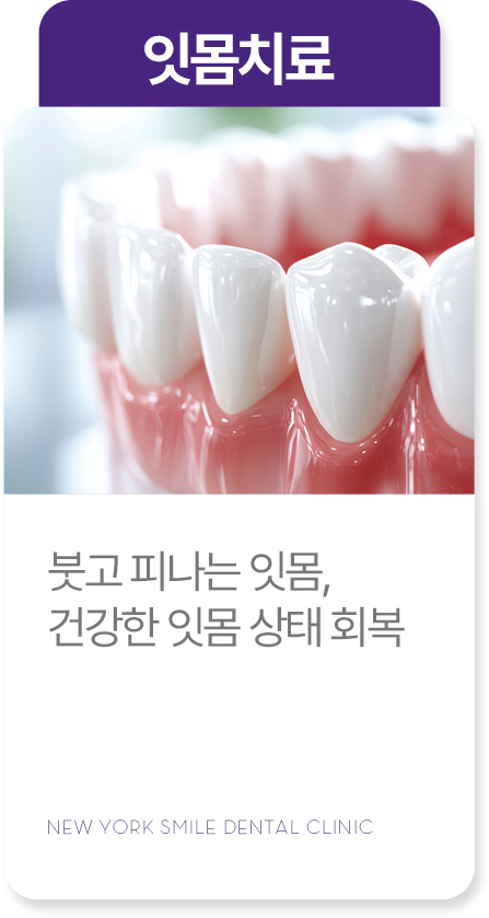 충치치료