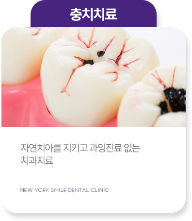 보철치료