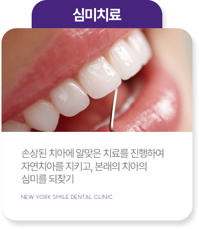 임플란트
