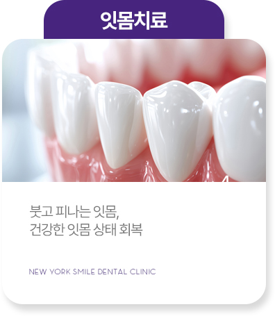 충치치료